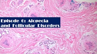 Episode 6: Alopecia and Follicular Disorders