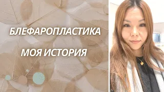 Vlog:Блефаропластика До/После👁️ Моя история | Astana🇰🇿Kazakhstan