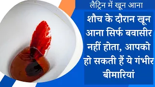 लैट्रिन में खून आना किन समस्याओं का संकेत | Blood in Stool: Causes & Treatment in Hindi