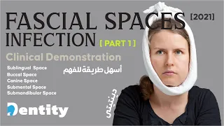 شرح مبسط | Fascial Spaces Infection [ PART 1/2 ]