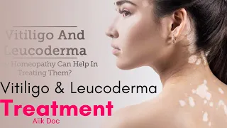 Dr Umme Raheel | leucoderma vitiligo Treatment Solution | Aiik TV