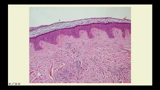 Basics of Dermatology (Part One) - CRASH! Medical Review Series