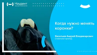 👉 Когда нужно менять коронки?