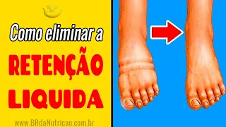 3 Dicas de Como Acabar com Retenção de Líquidos