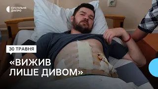 «Таке поранення – майже завжди см*рть»: в одному з медзакладів Дніпропетровщини лікують військового