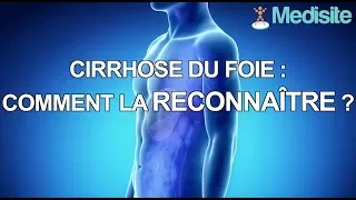 Reconnaître les signes d'une cirrhose du foie