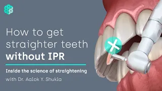 How to get straighter teeth without IPR | Inside the science of teeth straightening