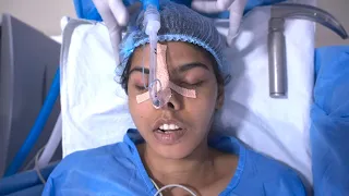 Young Lady Going under Anesthesia for Face Reconstruction