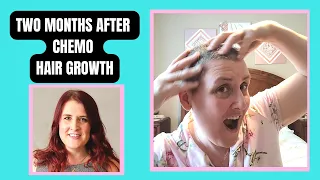 2 months after chemotherapy Hair Growth | Breast Cancer Stage 2a | My Cancer Journey