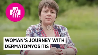 Dermatomyositis patient: Woman's journey with an uncommon skin and muscle disease
