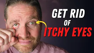 BEST 5 Tips For Red Itchy Eyes From Eye Allergies