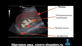 Нефрокальциноз. Бесплатные лекции для врачей shopdon.ru