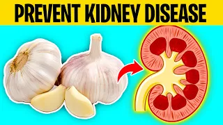 Eat These 9 Foods to Prevent Kidney Disease