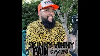 Skinny Vinny | Narcan Saving His Life From Overdose To America's Got Talent & Working With Steve-O