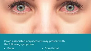 How is Conjunctivitis Related to COVID-19? | Apollo Hospitals