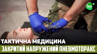 Тактична Медицина. Закритий напружений пневмоторакс. Надання Медичної Допомоги в Укритті.