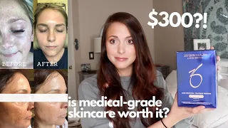 MY SKINCARE ROUTINE: ZO SKIN HEALTH REVIEW AND 1 MONTH RESULTS | is medical-grade worth the money?