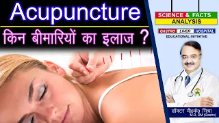 ACUPUNCTURE किन बीमारियों का इलाज ? || ACUPUNCTURE THE MEDICAL FACTS