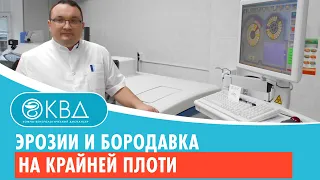 😦 Эрозии и бородавка на крайней плоти. Клинический случай №483