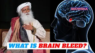 Sadhguru Undergoes Surgery For Chronic Brain Bleed; What Is The Condition & What Are The Symptoms?