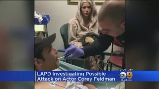 Corey Feldman Claims He Was Stabbed In Tarzana; Police Investigating