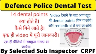 SSC GD DENTAL CHECKUP | Medical ke time dental points kase count hote he |