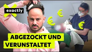 Pfusch und Betrug: Das Geschäft mit dem Haarausfall | Doku | exactly