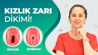 Kızlık Zarı Dikimi (Hymenoplasty) | Op.Dr. Ebru Ünal | 0 532 632 4034