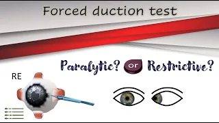 Forced duction test │Active force generation test