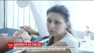 Обпечене тіло і тяжкий стан: батьки 4-річної Таї просять допомогти усіх небайдужих