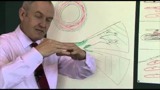 Heart disease 6, Pathophysiology of coronary heart disease