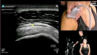 Webinar: Diagnostic Shoulder Exams - Lateral Shoulder