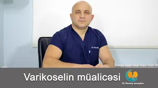 Varikoselin müalicəsi