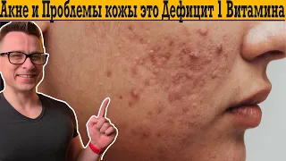 Акне и Проблемная КОЖА это Дефицит ￼всего 1 ВИТАМИНА!