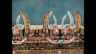 Electrolyte imbalance-Gastroenterology