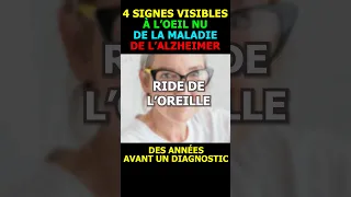 #shorts 4 signes visibles à l'oeil nu et précoce de la maladie de l'Alzheimer