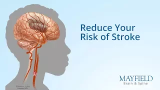 Reduce Your Risk of Stroke