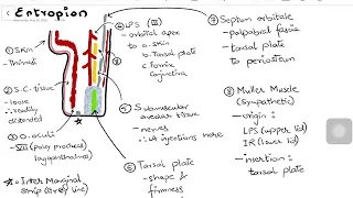 Entropion - with Lid Anatomy & Surgical Management