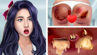 ASMR Treat infected wounds on the buttocks & Remove dog ticks | Deep Cleaning Animation