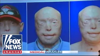 Disfigured firefighter says he would run into a burning building again