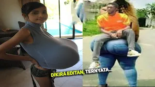 Gak Nyangka Sebesar ini ! Inilah Orang² Dengan Anggota Tubuh Teraneh Dan Terbesar