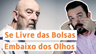 Descubra Por que Aparecem as Bolsas Embaixo dos Olhos e Como se Livrar Delas | Dr. Rafael Freitas