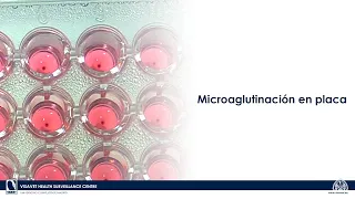 Microaglutinación en placa