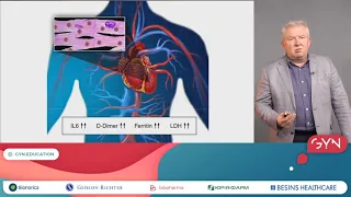 Професор Дуда О К   COVID 19 особливості клиничного перебігу