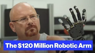 The Robot-Arm Prosthetic Controlled by Thought