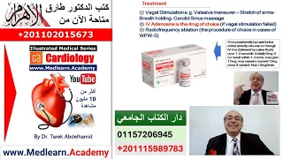 Supraventricular Tachycardia (SVT) #cme #internal_medicine #medical #usmle #محاضرات_باطنة