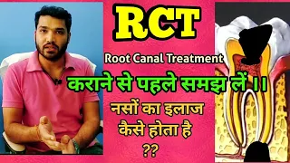 RCT in Hindi l what is root canal treatment ? (English Subtitle)