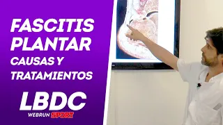 Fascitis plantar, causas y tratamientos