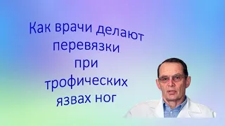 Как врачи делают перевязки при язвах. Беседа для ВСЕХ и для врачей.