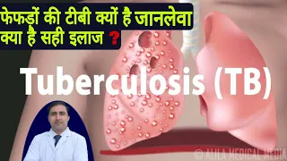 फेफड़ों की टीबी क्यों है जानलेवा क्या है सही इलाज ? || TUBERCULOSIS (TB) Dr Kumar Education clinic